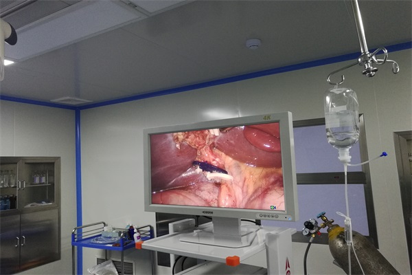 腹腔镜监视器 腹腔镜监视器